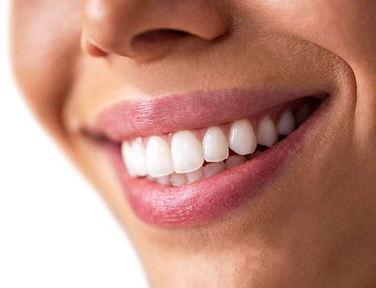 Close-up of woman’s smile with perfect teeth