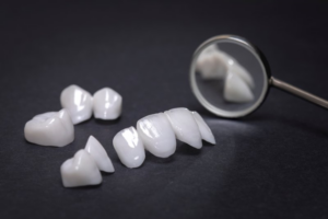 Porcelain veneers lounging on a grey tabletop with magnifying glass